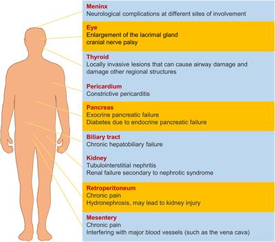 IgG4-related digestive diseases: diagnosis and treatment